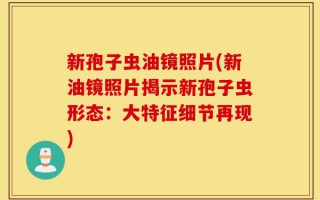 新孢子虫油镜照片(新油镜照片揭示新孢子虫形态：大特征细节再现)