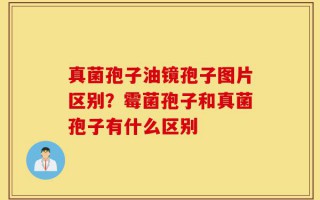 真菌孢子油镜孢子图片区别？霉菌孢子和真菌孢子有什么区别