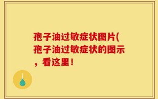 孢子油过敏症状图片(孢子油过敏症状的图示，看这里！