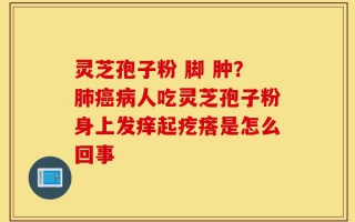 灵芝孢子粉 脚 肿？肺癌病人吃灵芝孢子粉身上发痒起疙瘩是怎么回事