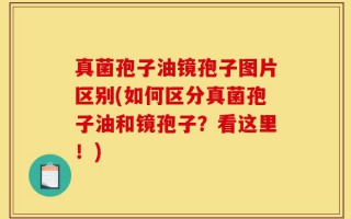 真菌孢子油镜孢子图片区别(如何区分真菌孢子油和镜孢子？看这里！)