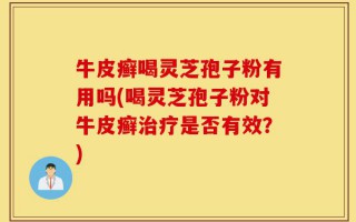 牛皮癣喝灵芝孢子粉有用吗(喝灵芝孢子粉对牛皮癣治疗是否有效？)