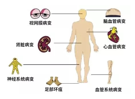 糖尿病人喝灵芝孢子粉好吗?-第1张图片-灵芝之家 糖尿病人喝灵芝孢子粉好吗?-第1张图片-灵芝之家