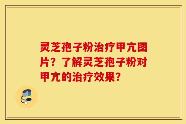 灵芝孢子粉治疗甲亢图片？了解灵芝孢子粉对甲亢的治疗效果？-第1张图片-灵芝之家