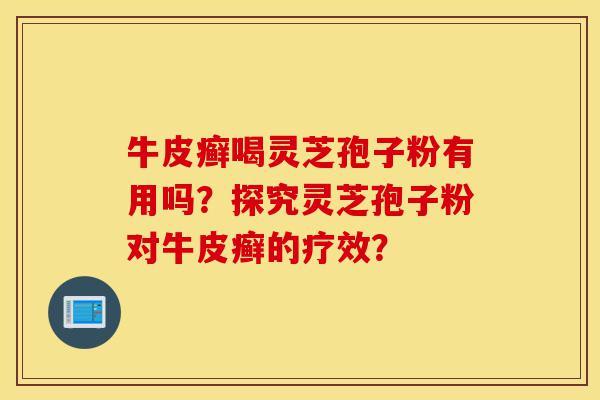 牛皮癣喝灵芝孢子粉有用吗?探究灵芝孢子粉对牛皮癣的疗效?-第1张图片-灵芝之家 牛皮癣喝灵芝孢子粉有用吗?探究灵芝孢子粉对牛皮癣的疗效?-第1张图片-灵芝之家