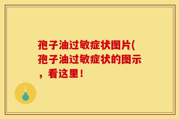 孢子油过敏症状图片(孢子油过敏症状的图示,看这里!-第1张图片-灵芝之家 孢子油过敏症状图片(孢子油过敏症状的图示,看这里!-第1张图片-灵芝之家