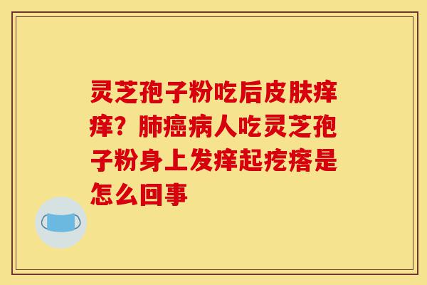 灵芝孢子粉吃后皮肤痒痒?肺癌病人吃灵芝孢子粉身上发痒起疙瘩是怎么回事-第1张图片-灵芝之家 灵芝孢子粉吃后皮肤痒痒?肺癌病人吃灵芝孢子粉身上发痒起疙瘩是怎么回事-第1张图片-灵芝之家