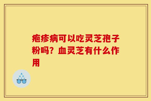 疱疹病可以吃灵芝孢子粉吗?血灵芝有什么作用-第1张图片-灵芝之家 疱疹病可以吃灵芝孢子粉吗?血灵芝有什么作用-第1张图片-灵芝之家