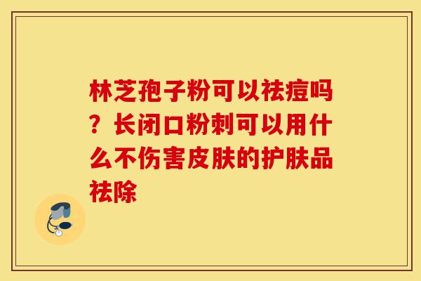 林芝孢子粉可以祛痘吗？长闭口粉刺可以用什么不伤害皮肤的护肤品祛除-第1张图片-灵芝之家
