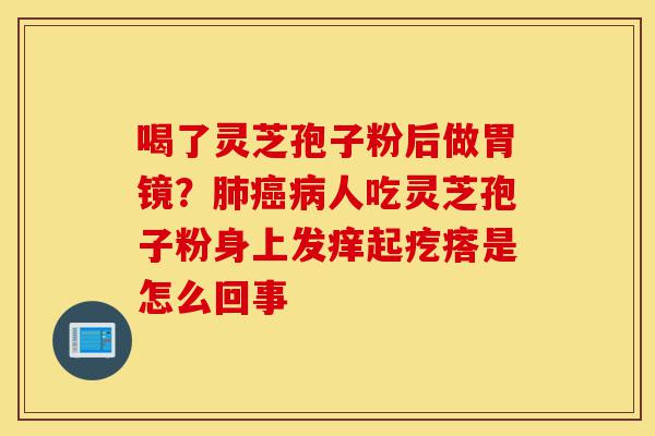 喝了灵芝孢子粉后做胃镜?肺癌病人吃灵芝孢子粉身上发痒起疙瘩是怎么回事-第1张图片-灵芝之家 喝了灵芝孢子粉后做胃镜?肺癌病人吃灵芝孢子粉身上发痒起疙瘩是怎么回事-第1张图片-灵芝之家