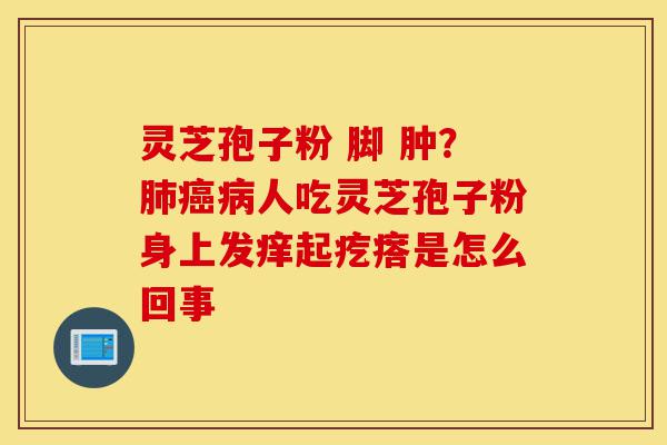 灵芝孢子粉 脚 肿?肺癌病人吃灵芝孢子粉身上发痒起疙瘩是怎么回事-第1张图片-灵芝之家 灵芝孢子粉 脚 肿?肺癌病人吃灵芝孢子粉身上发痒起疙瘩是怎么回事-第1张图片-灵芝之家