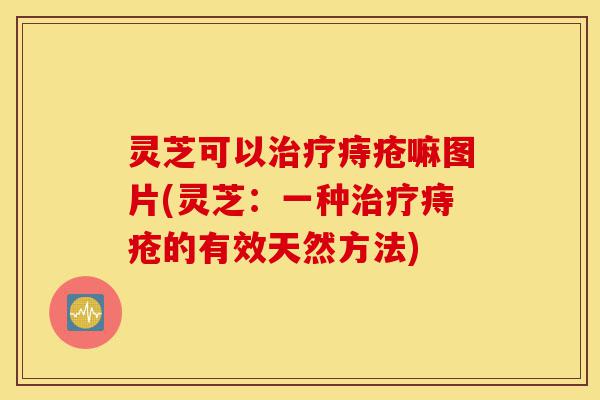 灵芝可以治疗痔疮嘛图片(灵芝:一种治疗痔疮的有效天然方法)-第1张图片-灵芝之家 灵芝可以治疗痔疮嘛图片(灵芝:一种治疗痔疮的有效天然方法)-第1张图片-灵芝之家