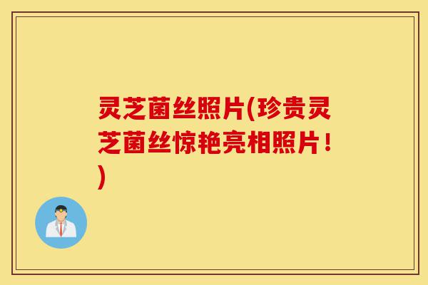 灵芝菌丝照片(珍贵灵芝菌丝惊艳亮相照片!)-第1张图片-灵芝之家 灵芝菌丝照片(珍贵灵芝菌丝惊艳亮相照片!)-第1张图片-灵芝之家
