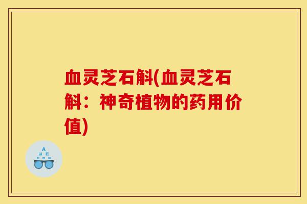 血灵芝石斛(血灵芝石斛:神奇植物的药用价值)-第1张图片-灵芝之家 血灵芝石斛(血灵芝石斛:神奇植物的药用价值)-第1张图片-灵芝之家