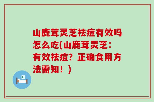 山鹿茸灵芝祛痘有效吗怎么吃(山鹿茸灵芝:有效祛痘?正确食用方法需知!)-第1张图片-灵芝之家 山鹿茸灵芝祛痘有效吗怎么吃(山鹿茸灵芝:有效祛痘?正确食用方法需知!)-第1张图片-灵芝之家